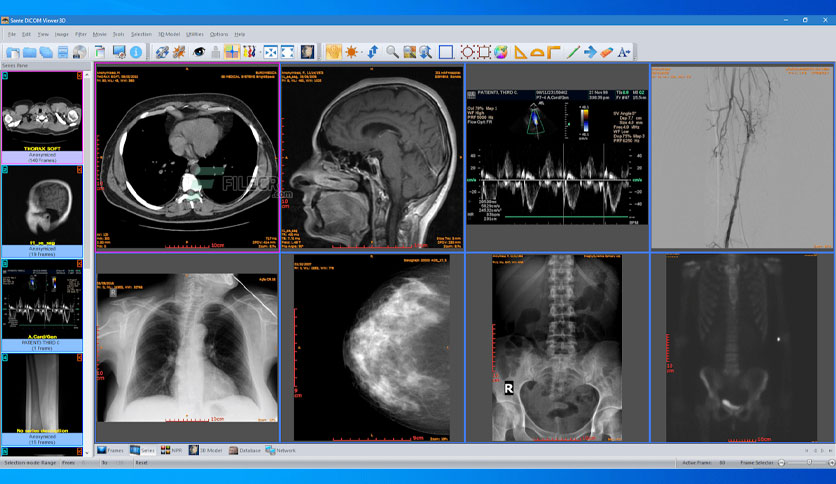 download the new version for mac Sante DICOM Viewer Pro 14.0.2