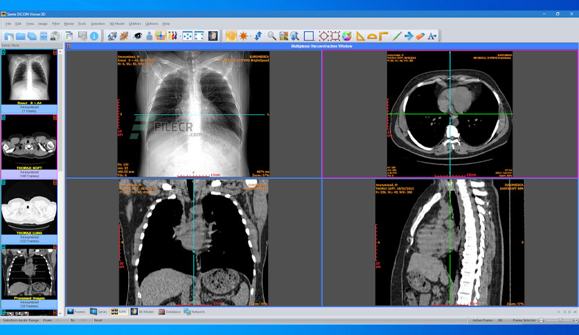 Sante DICOM Viewer Pro 14.0.1 download the new version for apple